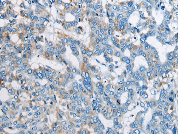OTUD7B Antibody