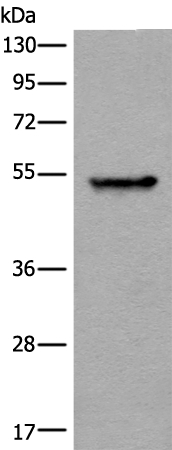 PFKFB4 Antibody