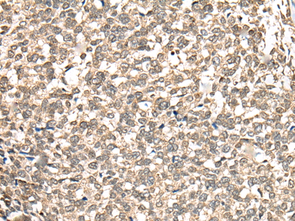 PHF21A Antibody