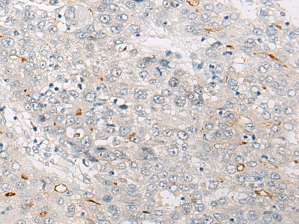 PNPO Antibody