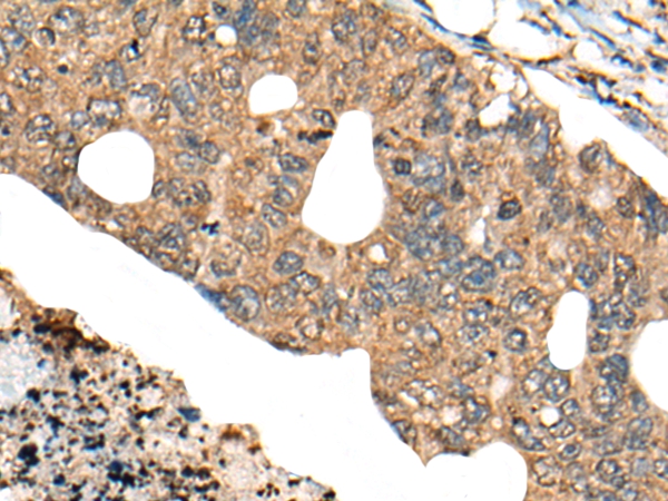 PPP3R1 Antibody