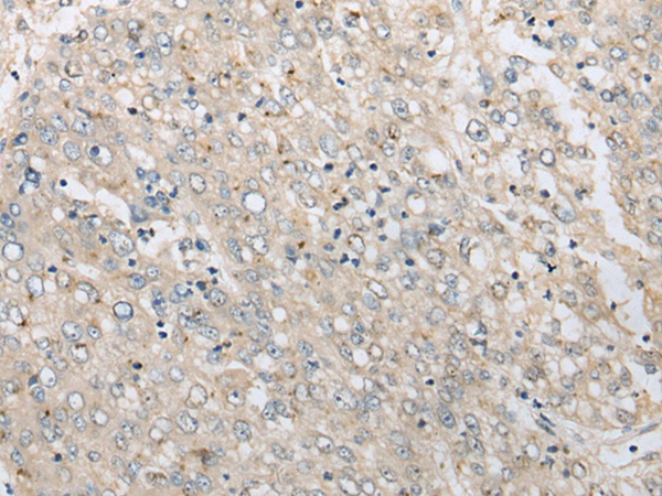 PRKACA Antibody