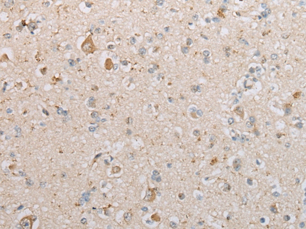 PRKACA Antibody