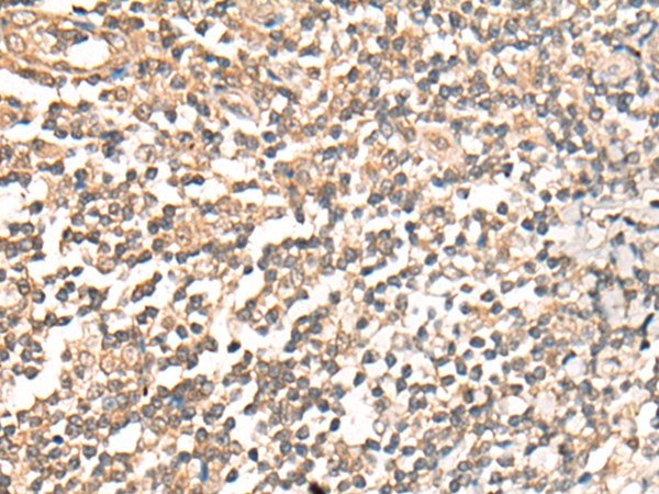 PRRX1 Antibody