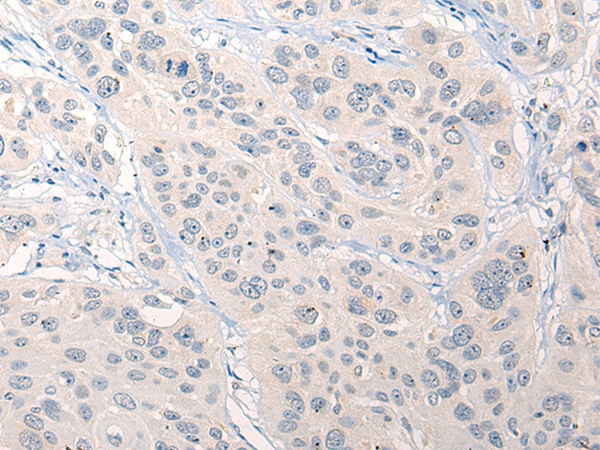 RNF138 Antibody