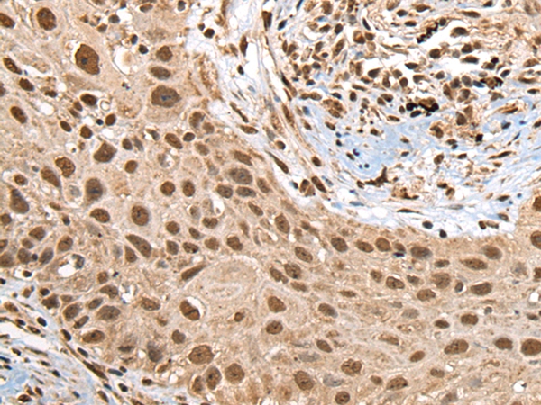 RTCB Antibody