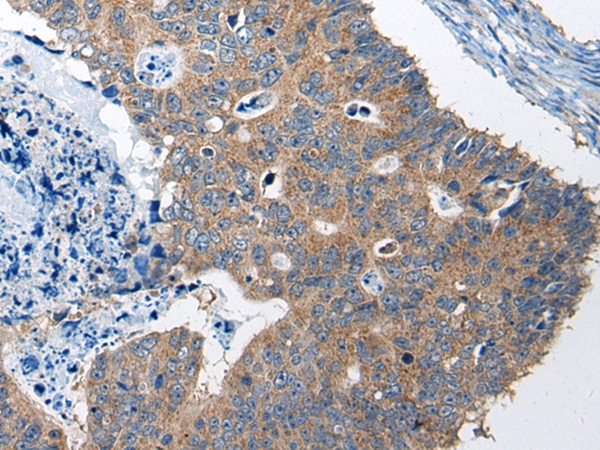RTN4IP1 Antibody