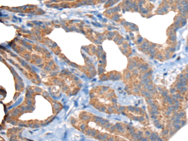 RTN4IP1 Antibody