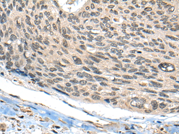 SARNP Antibody