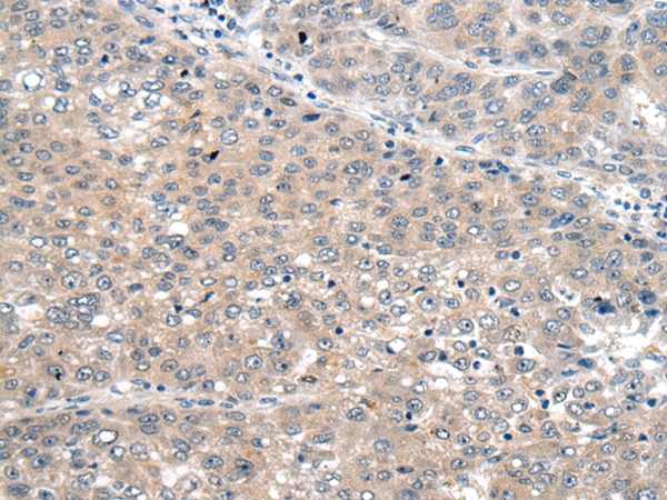 SEMA4D Antibody