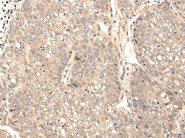 STAP1 Antibody