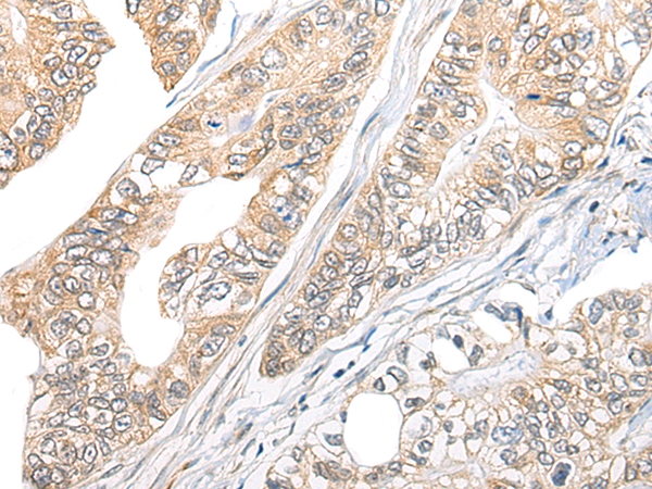TBCB Antibody