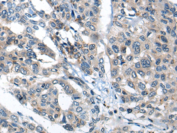 THRA/THRB Antibody