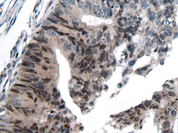 THRA/THRB Antibody