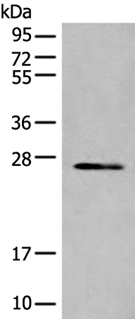 TIMM21 Antibody
