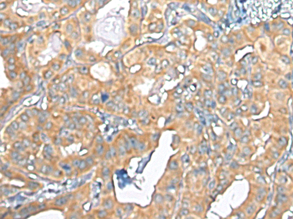 TMEM256 Antibody