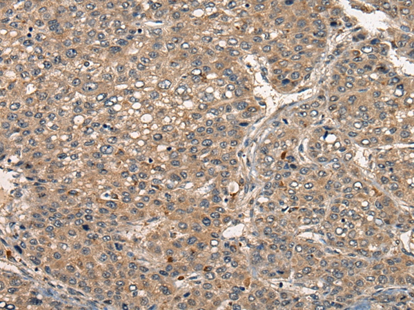 TNFSF8 Antibody