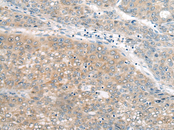 UBE2G2 Antibody