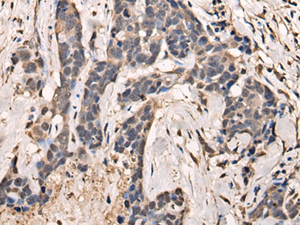 UBE2M Antibody