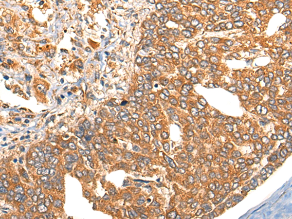 UBIAD1 Antibody