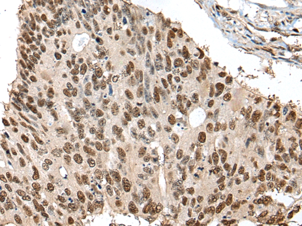 UBR7 Antibody