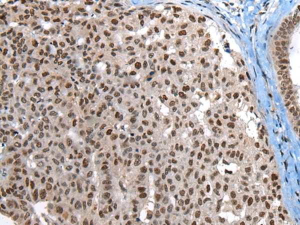 UBR7 Antibody