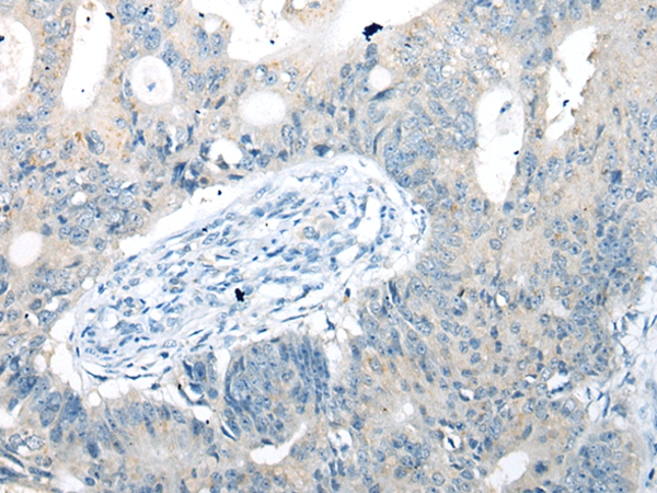UBXN10 Antibody