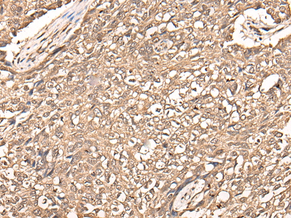 USP21 Antibody