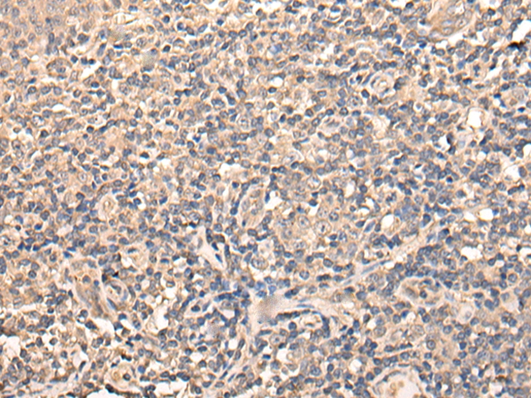 USP38 Antibody
