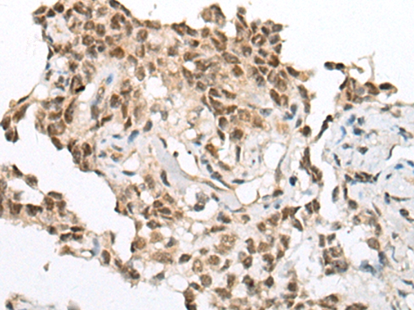 UTP18 Antibody