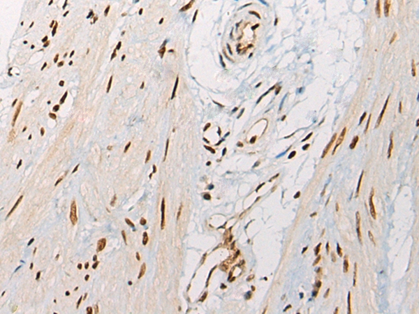 VGLL3 Antibody