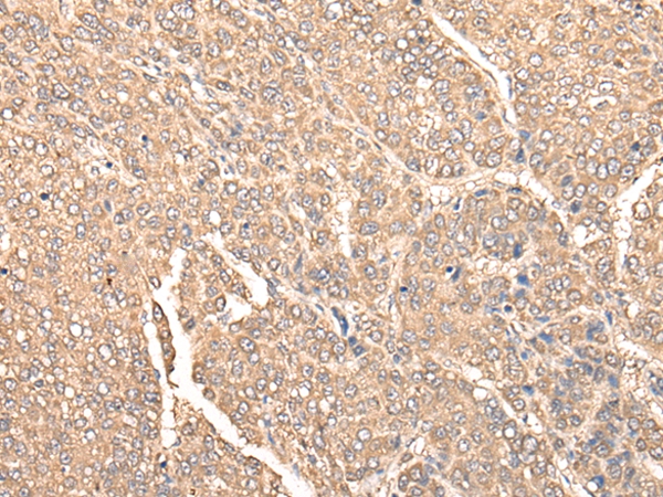 WDFY1 Antibody