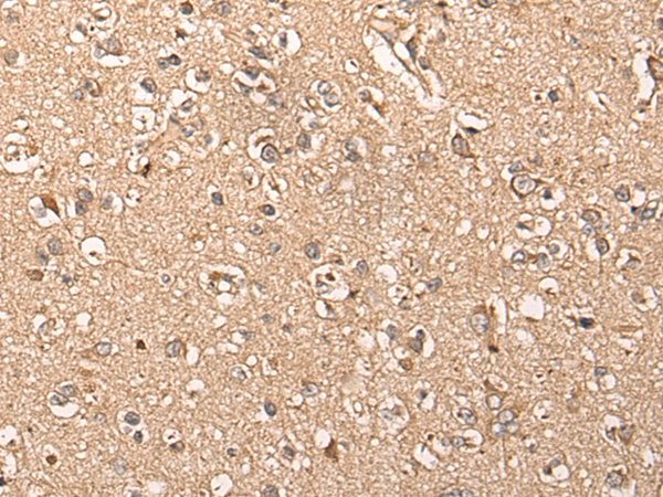 WDFY4 Antibody