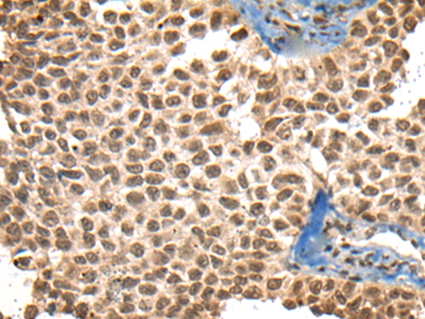 XPO1 Antibody