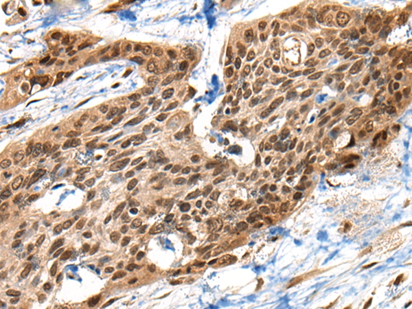 XPO1 Antibody
