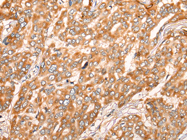 ZMYND10 Antibody