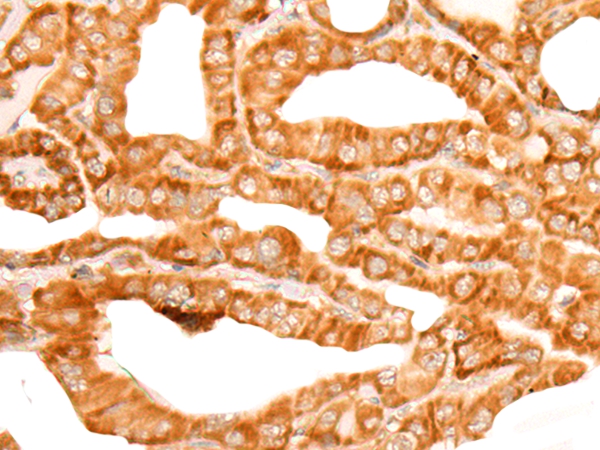 ZMYND10 Antibody