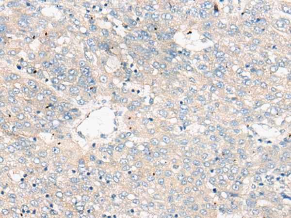 ZNF449 Antibody