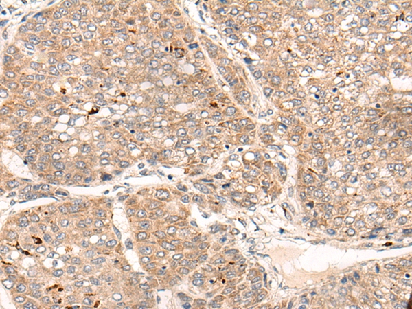 ZNF467 Antibody