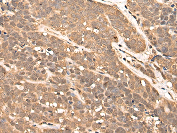 ZPR1 Antibody