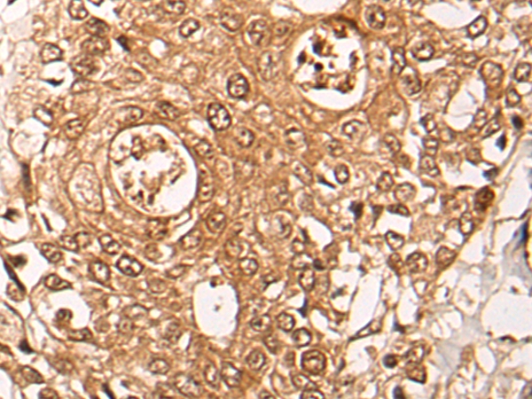 ZPR1 Antibody