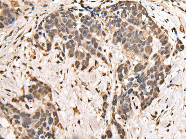 ZSCAN29 Antibody