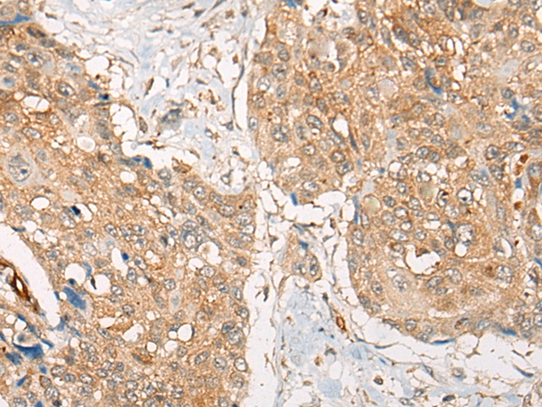 ZXDA Antibody