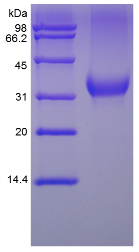 Recombinant Human EPO-a (rHu EPO-a)