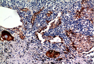 Mucin 1 Polyclonal Antibody