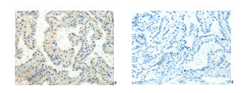 HTR2A Antibody