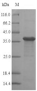 Recombinant Human Ras-related protein Rab-8A(RAB8A),partial