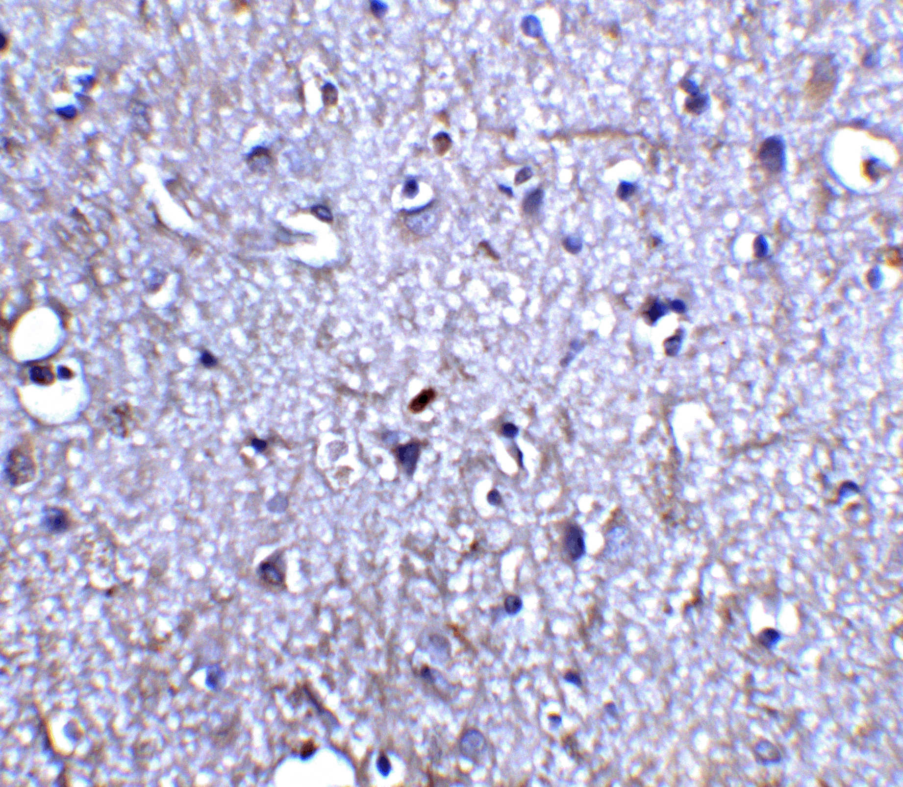 Neurturin Antibody