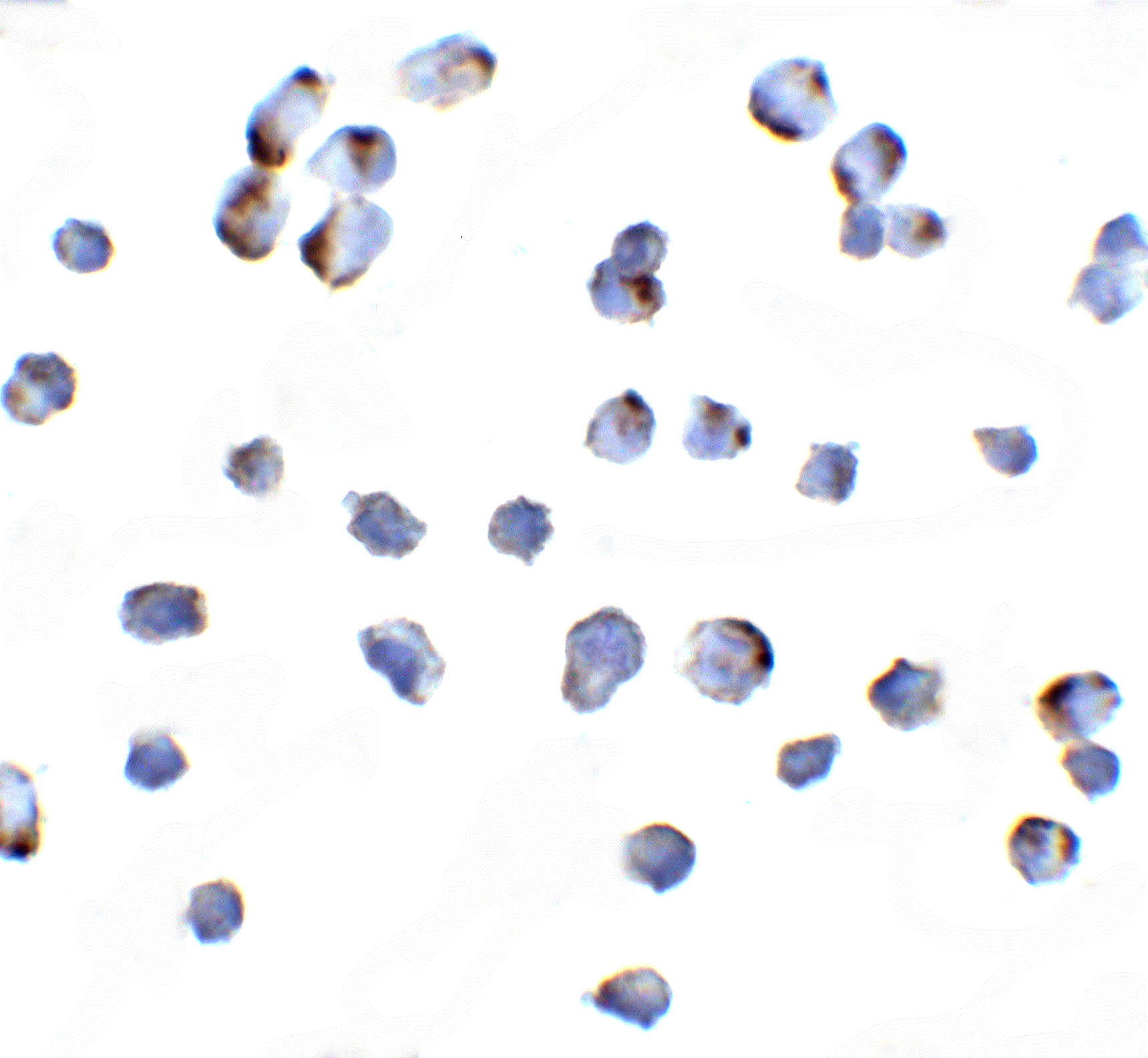 NIK Antibody