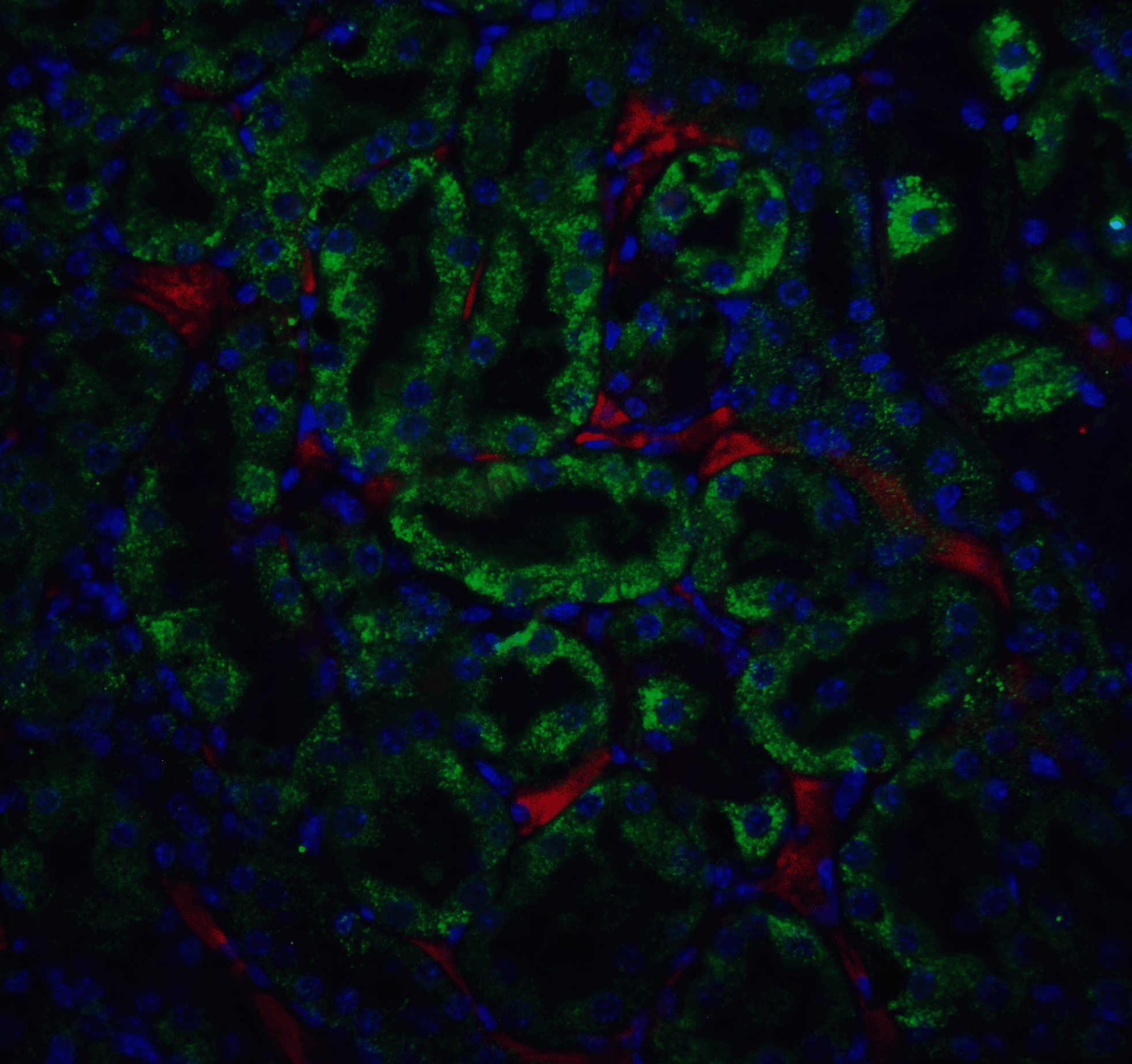 CAD Antibody
